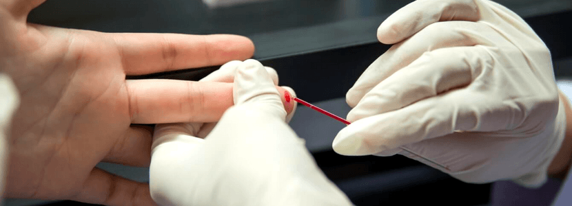 Concurso Cbmerj: teste de HIV poderá ser excluído do edital